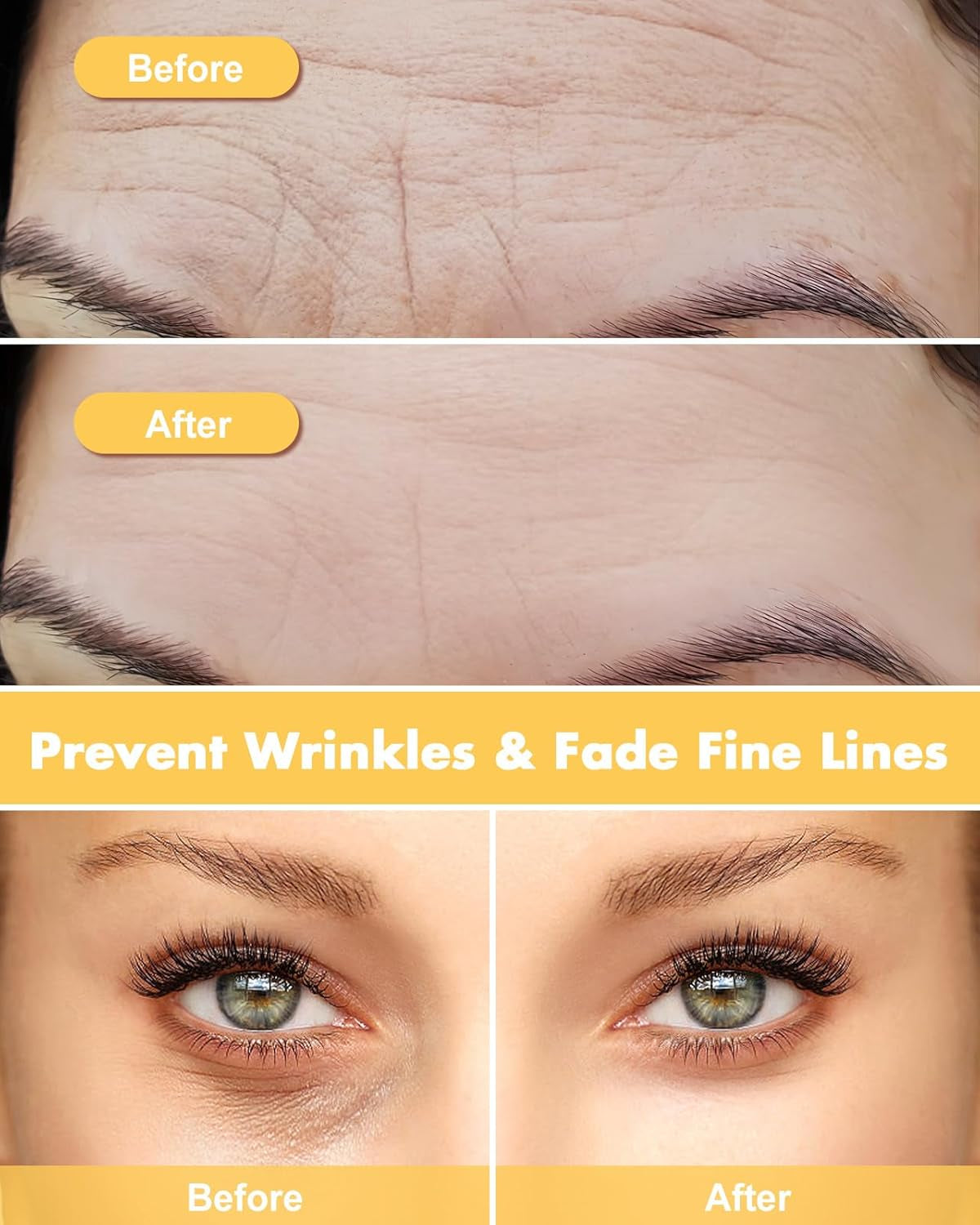 Silicone Forehead Wrinkle Patch - Non-Glue Reusable Forehead Wrinkle Patch and Eye Patches Set, Silicone Patches for Wrinkles, for Use with Face Cream or Lotion, Metal Eye Massage Stick&Tin Case, Gold