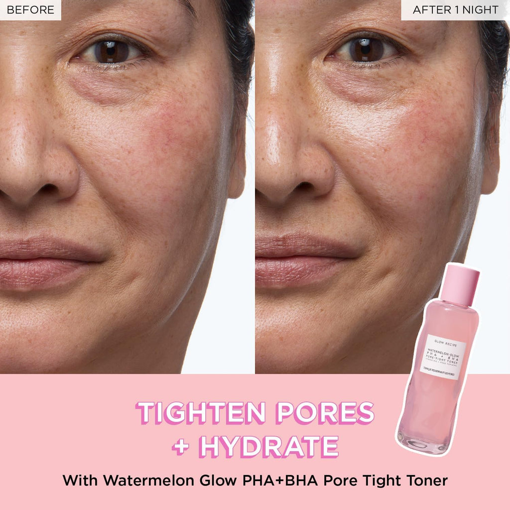 Watermelon Glow Icons Skin Care Gift Set - Niacinamide Dew Drops Face Serum (40Ml) + PHA + BHA Pore Minimizing Toner with Hyaluronic Acid (150Ml) + Pink Juice Facial Moisturizer (25Ml)