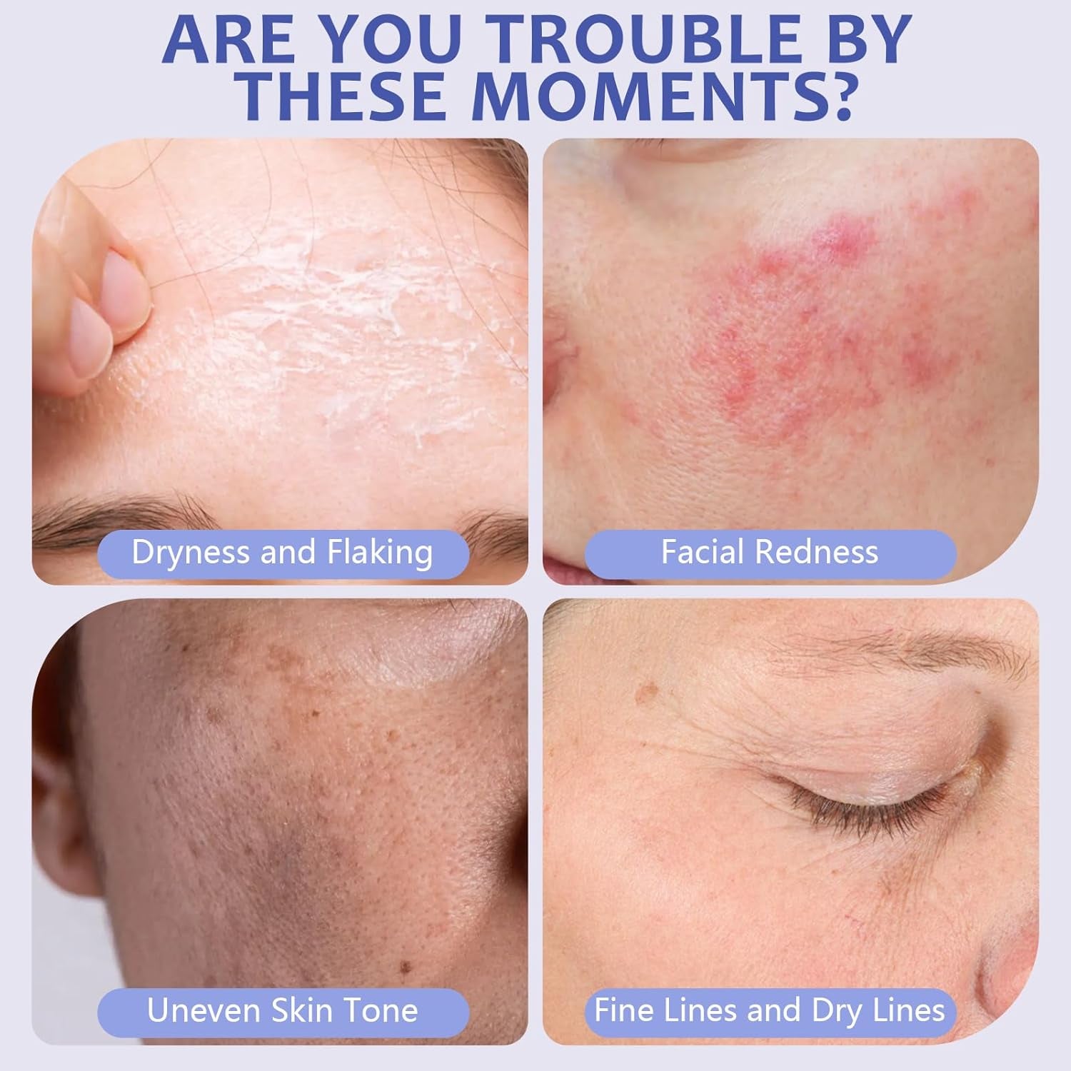 Dewy Skin Cream, Hydrating Face Moisturizer for Dry & Dull Skin, Long-Lasting Hydration Facial Cream, Lightweight Non-Greasy Formula, Plumps & Smooths Skin, Daily Skincare for All Skin Types